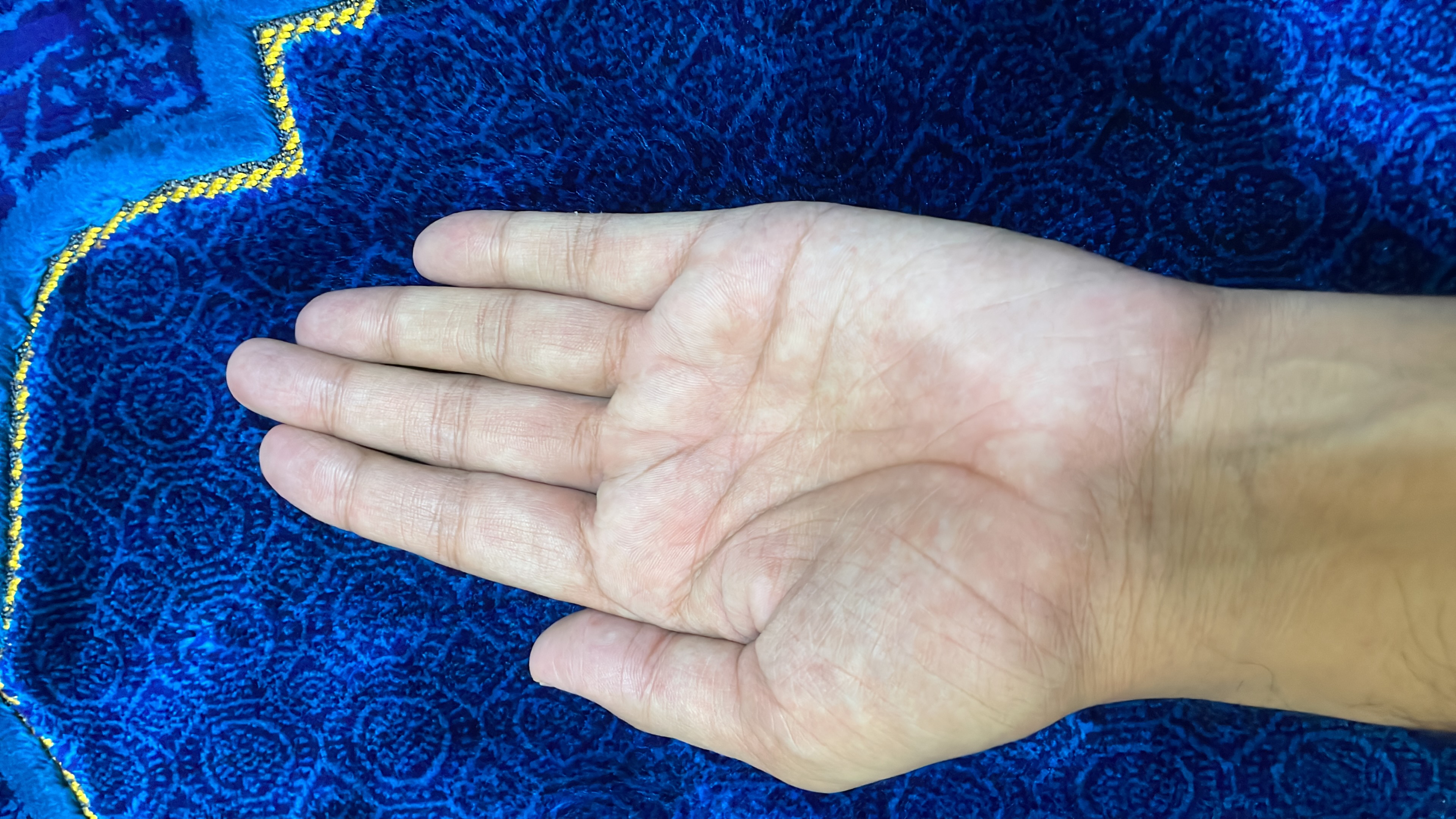 Left Hand Front