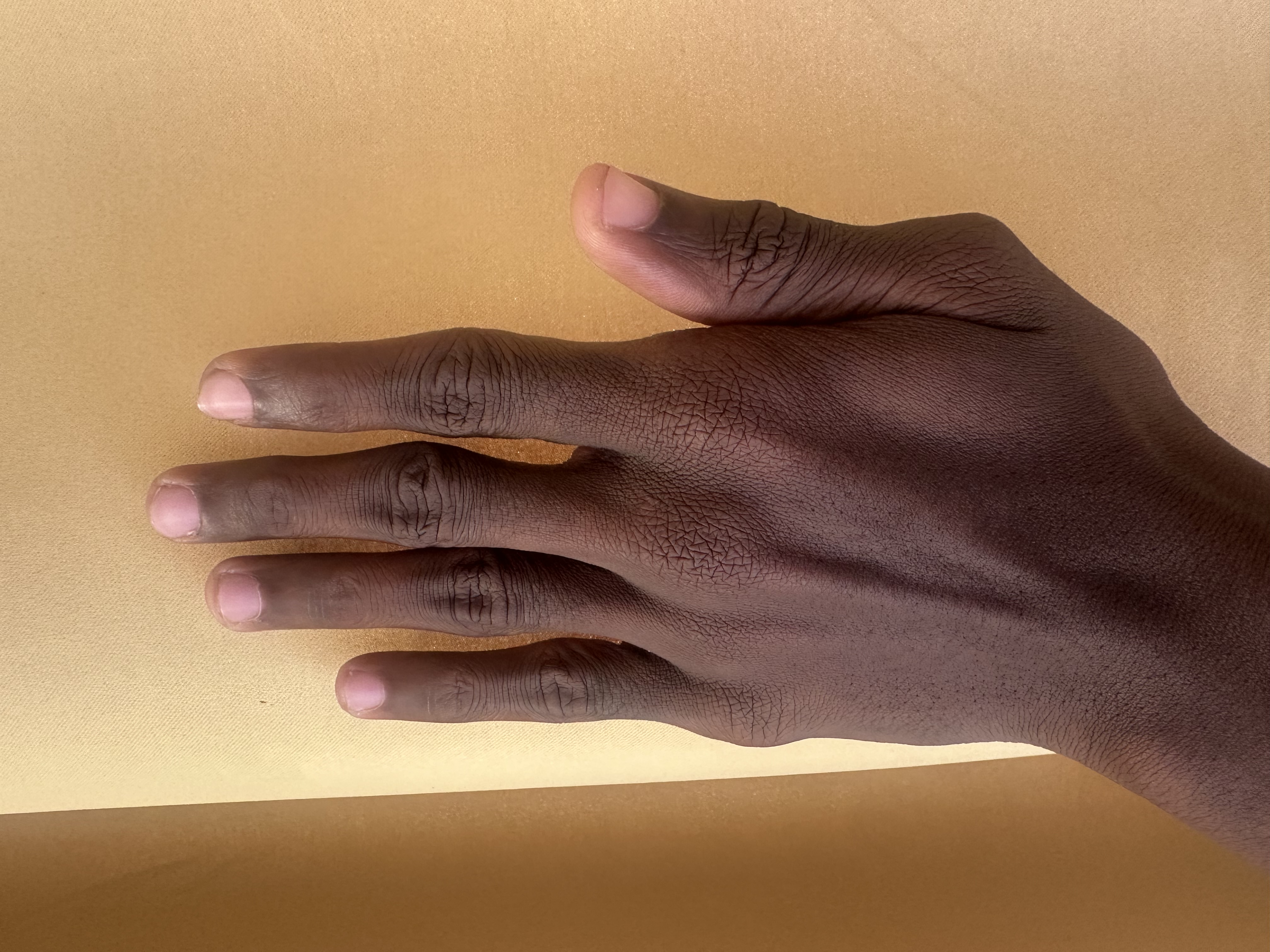 Left Hand Back