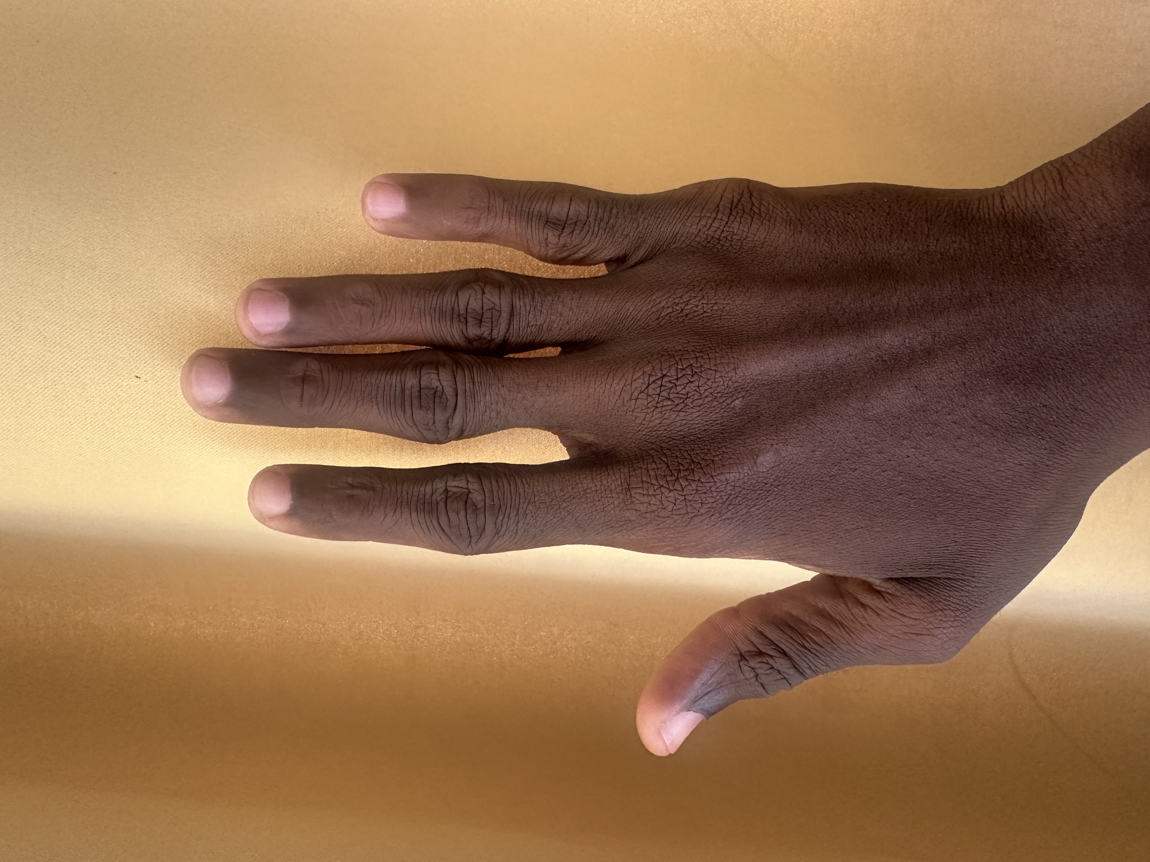 Right Hand Back