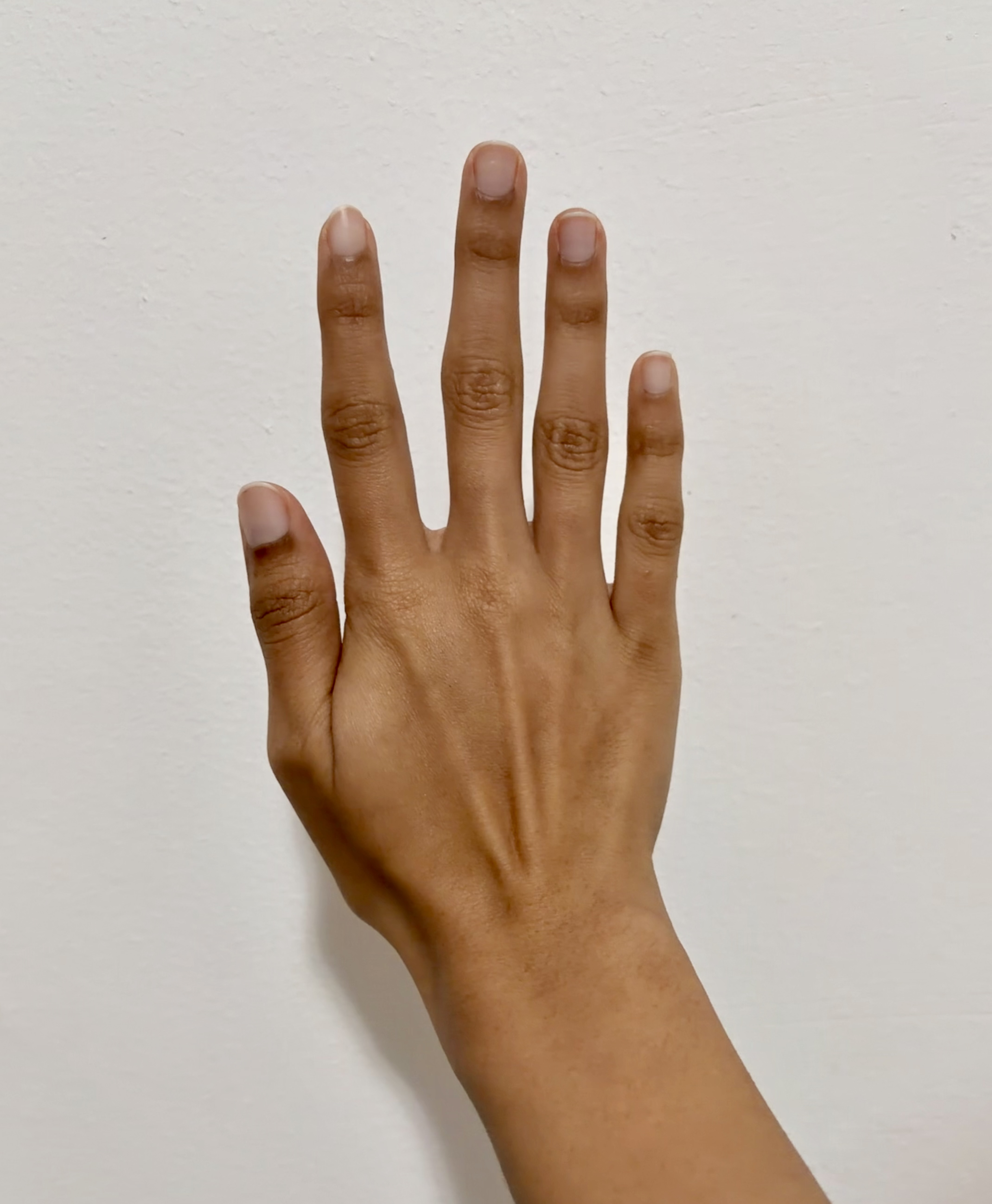 Right Hand Front