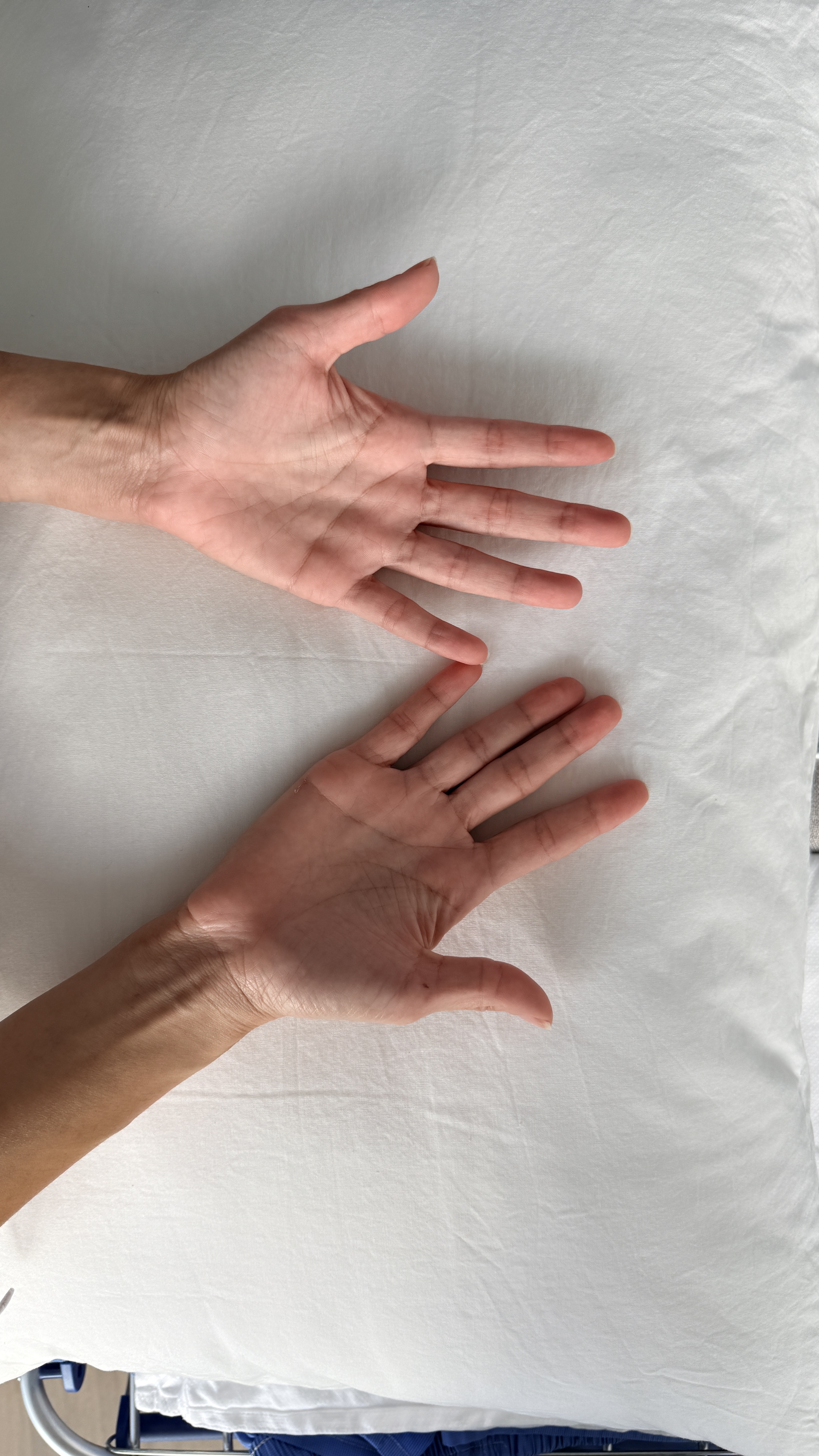 Left Hand Back