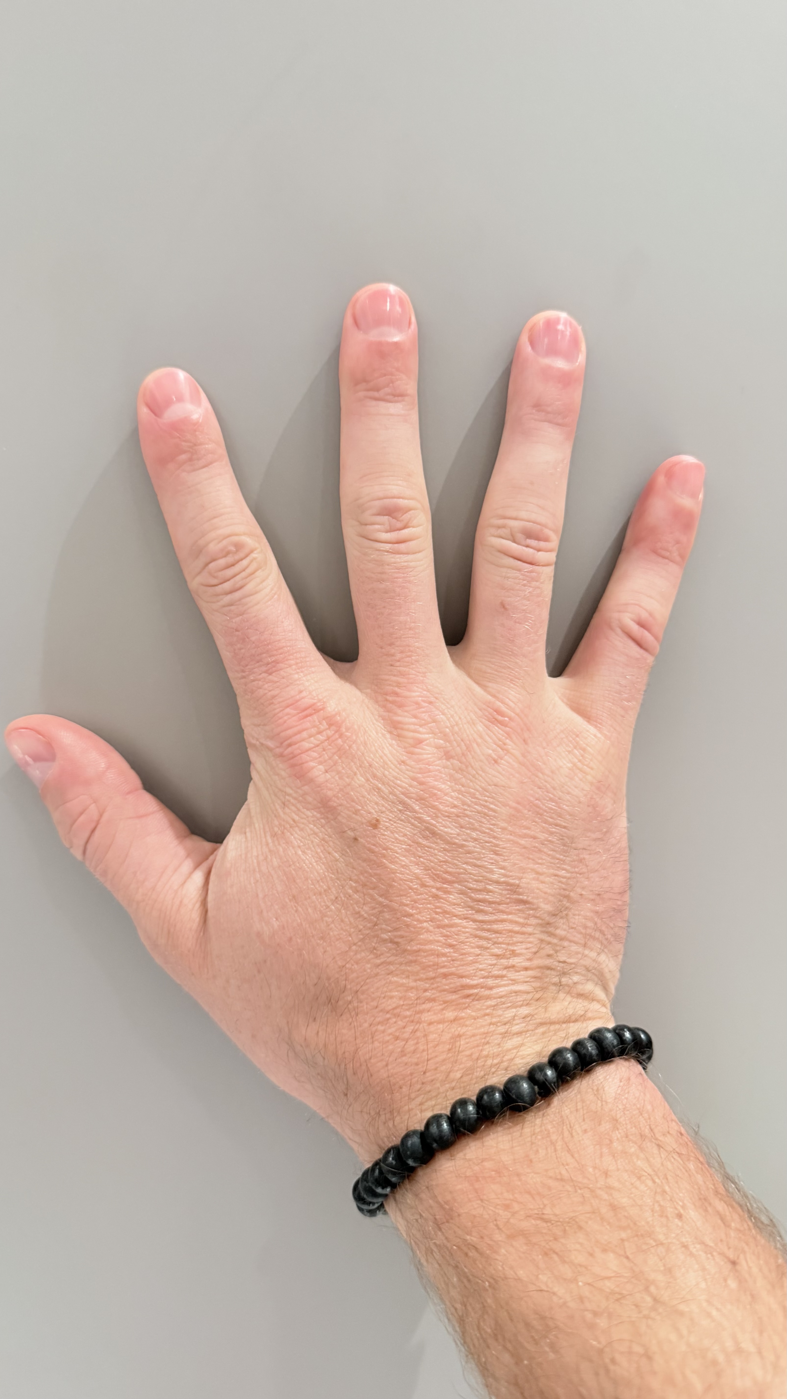 Left Hand Back