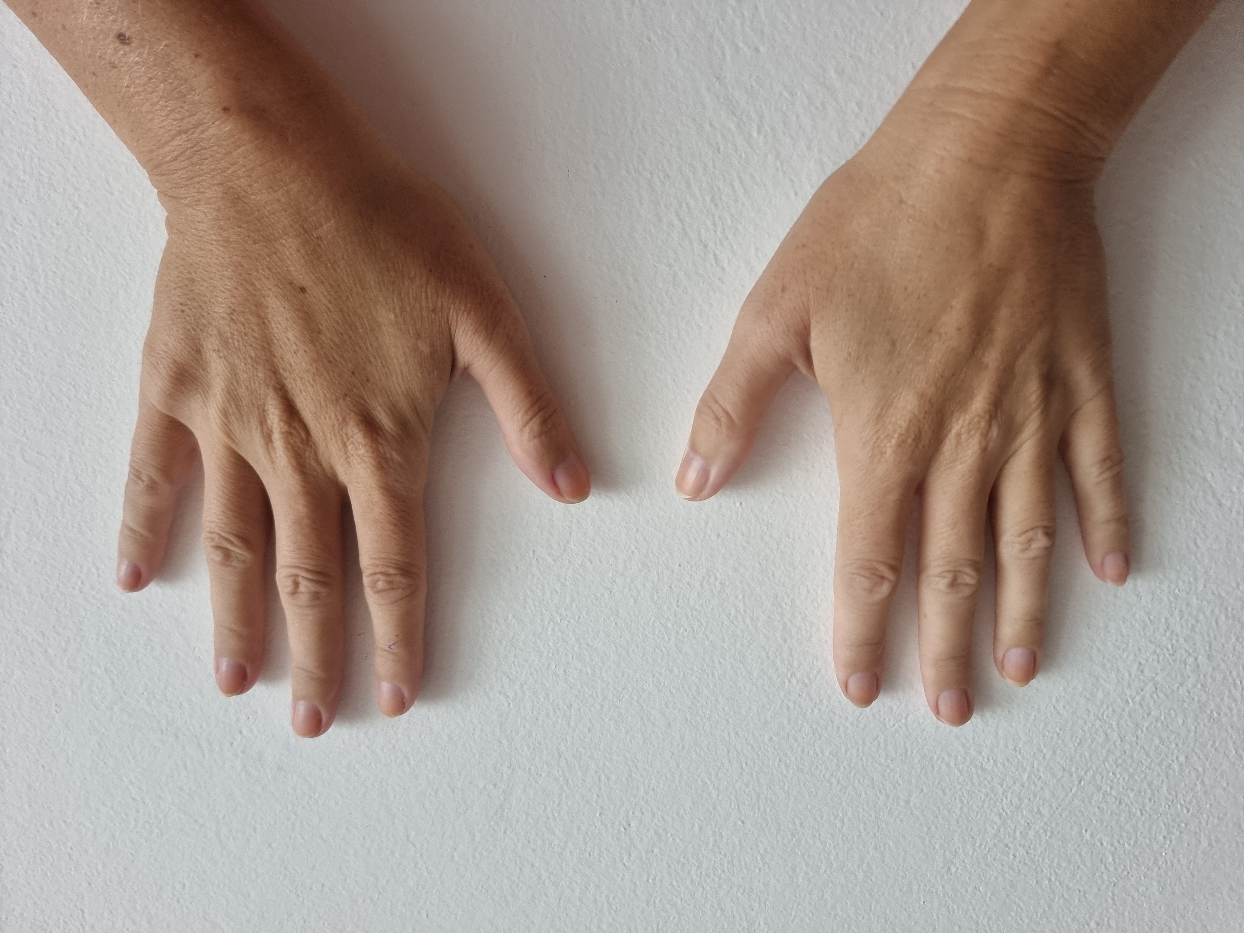 Right Hand Front