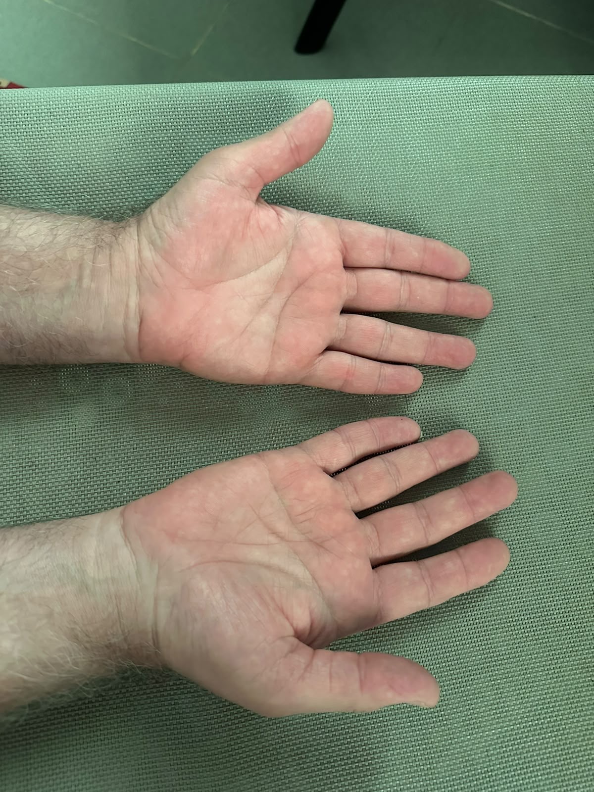Left Hand Back